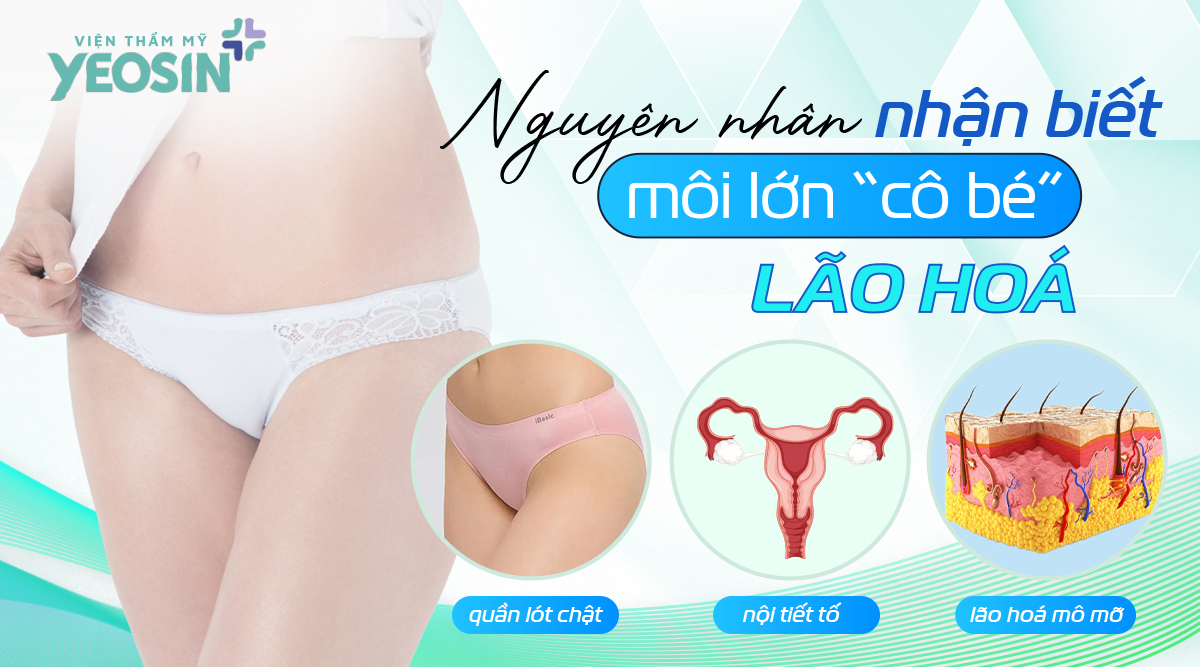 Nguyên nhân và các dấu hiệu nhận biết môi lớn “cô bé” bị lão hóa