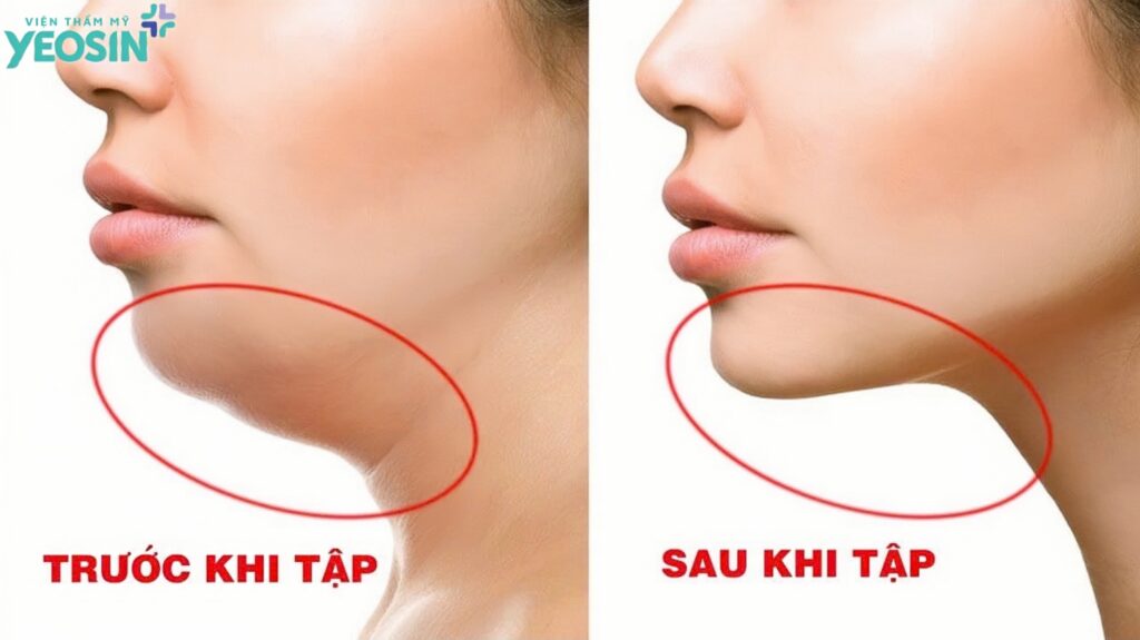 5 Cách giảm mỡ nọng cằm hiệu quả nhanh hiện nay 11 quality restoration 20260909095049101