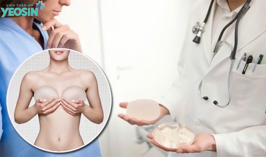 Có nên nâng ngực phẫu thuật