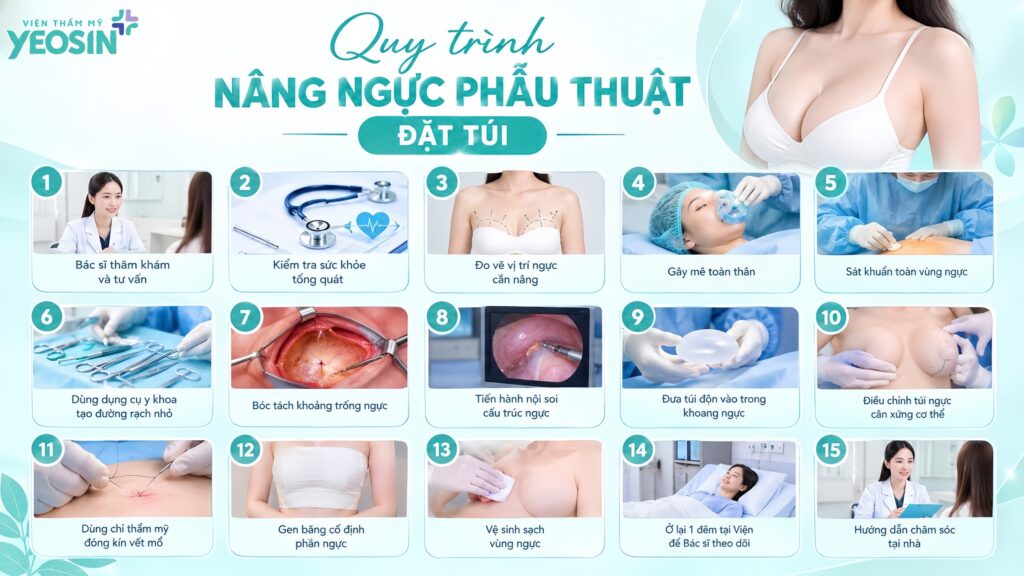 Quy trình nâng ngực phẫu thuật tại Yeosin
