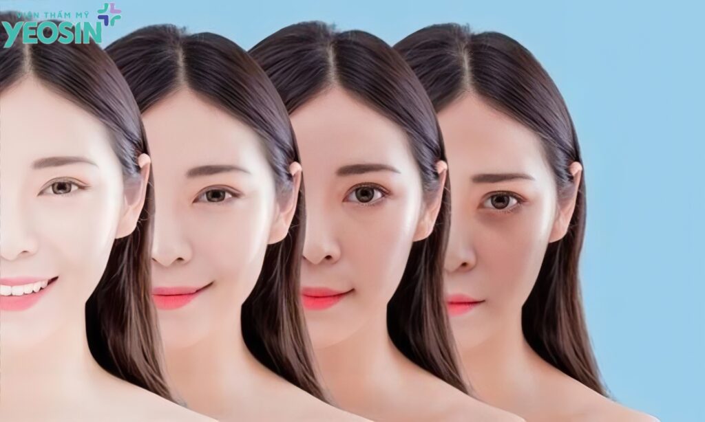 Truyền trắng da là gì? Những điều cần biết truyền trắng da an toàn và hiệu quả. 14 Truyền trắng da hiệu quả bao lâu?