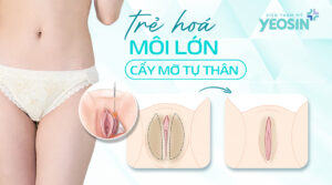 tre hoa moi lon bang cay mo tu than