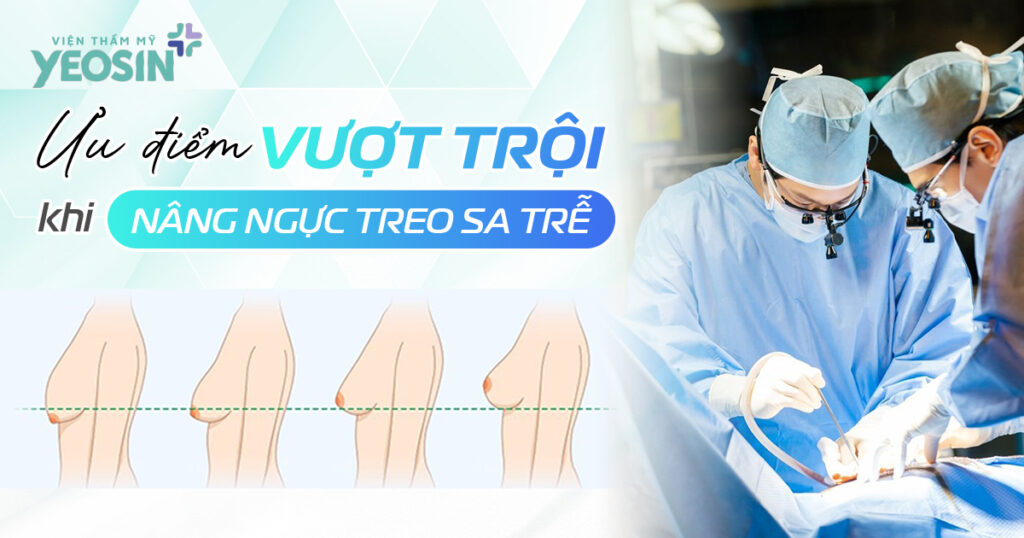 Ưu điểm vượt trội khi nâng ngực treo sa trễ