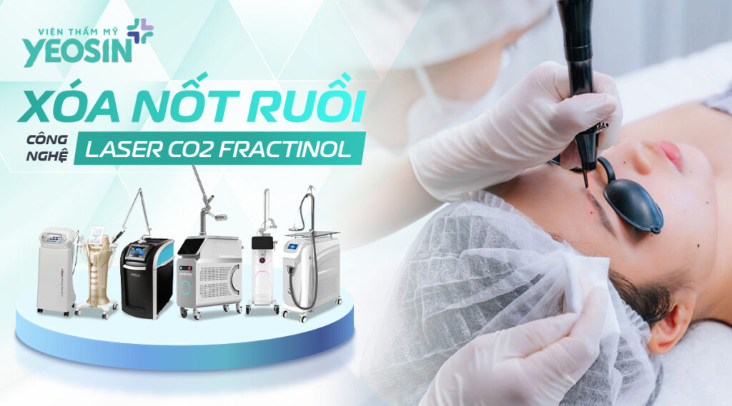 Laser CO2 Fractional - Công nghệ tẩy nốt ruồi không đau, không sẹo