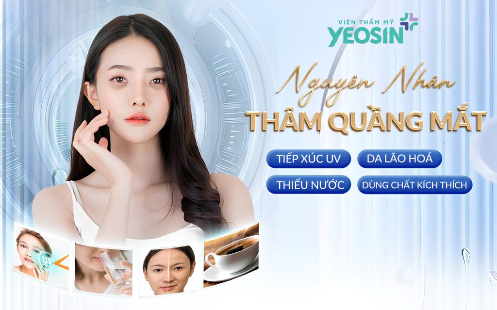 Tại sao chúng ta lại bị thâm quầng mắt?