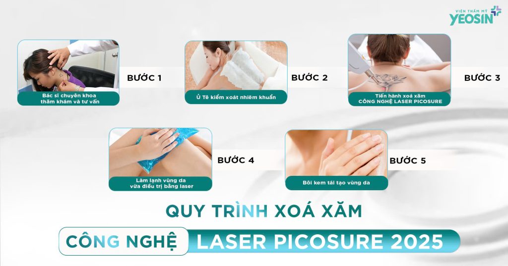 Quy trình xóa hình xăm bằng công nghệ Laser Pico tại Yeosin