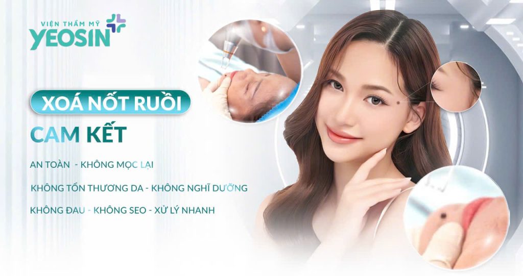 Tẩy nốt ruồi - Xóa nốt ruồi không để lại sẹo bằng Laser CO2 Fractional 28 Cam kết khi tẩy nốt ruồi tại Yeosin