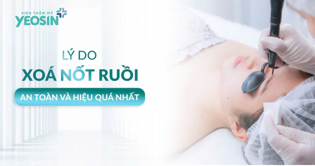 Tẩy nốt ruồi - Xóa nốt ruồi không để lại sẹo bằng Laser CO2 Fractional 23 Điều gì khiến bạn muốn đi tẩy nốt ruồi?