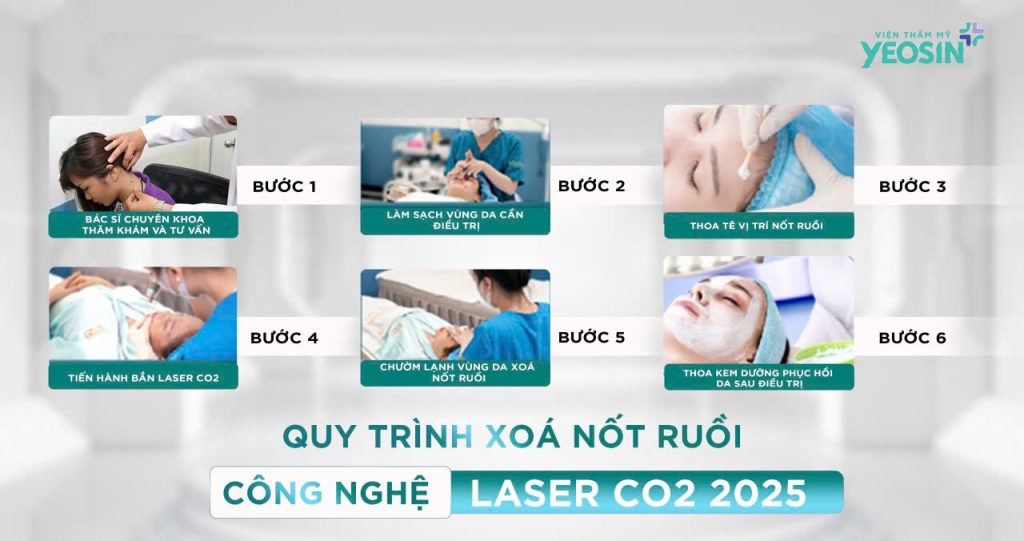 Tẩy nốt ruồi - Xóa nốt ruồi không để lại sẹo bằng Laser CO2 Fractional 26 Quy trình xóa nốt ruồi bằng laser CO2 tại Viện Thẩm Mỹ Yeosin.