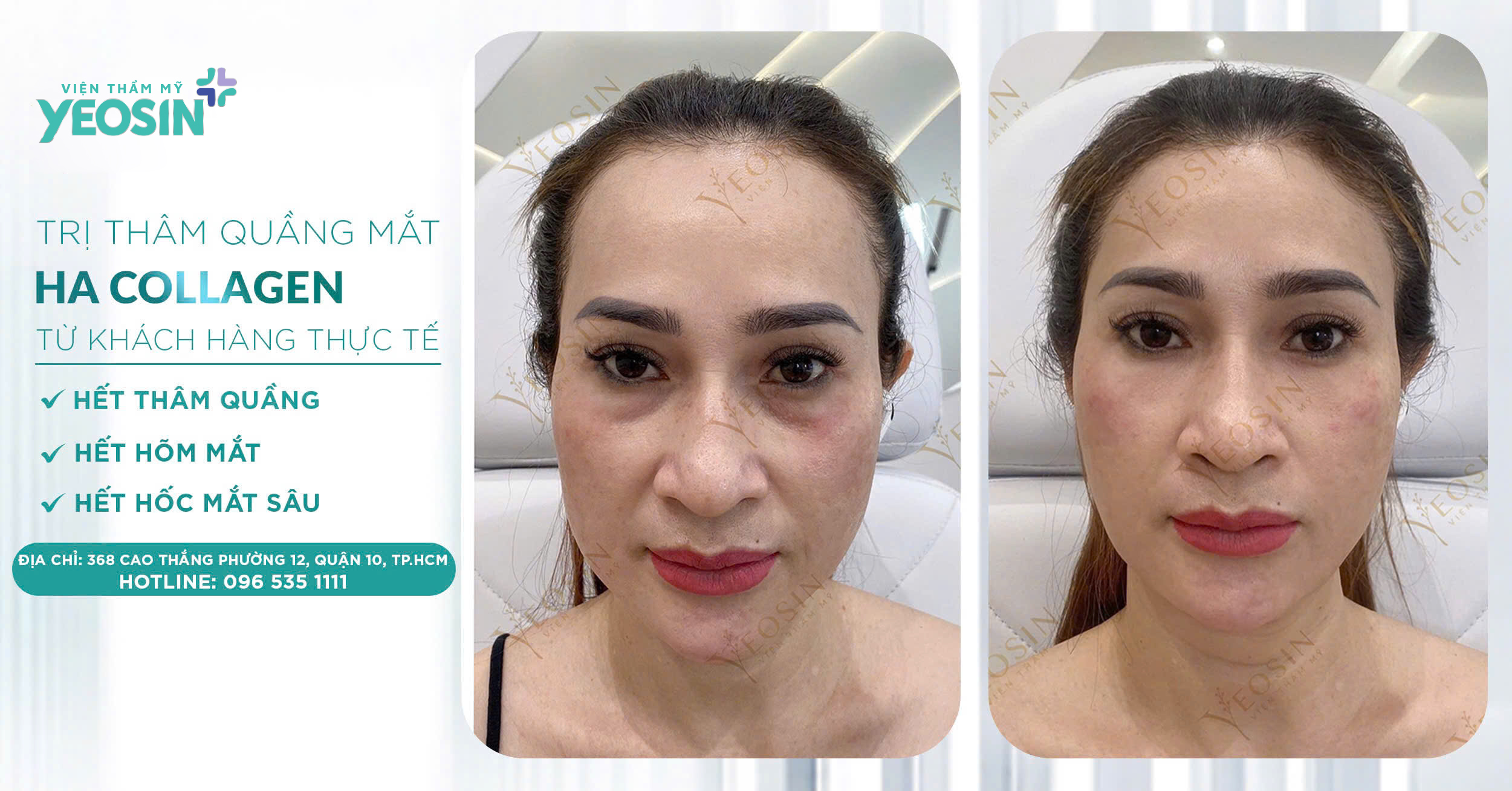 z6532622212916 9b4ae3e2085295d6d7afa2ac0e24f94e 1