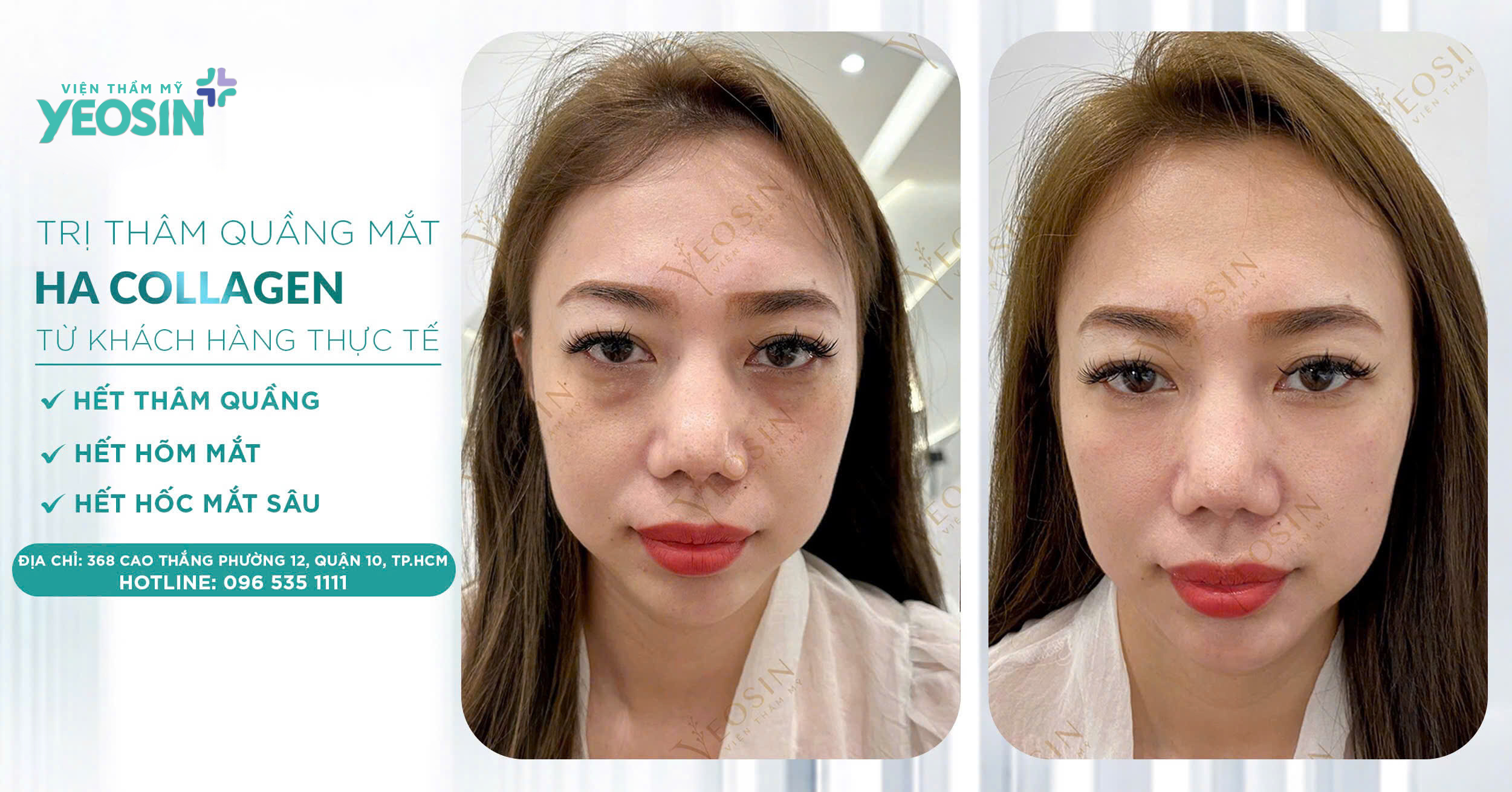 z6532622335671 71e2615b71a29e731e663866fc4f7cec 1