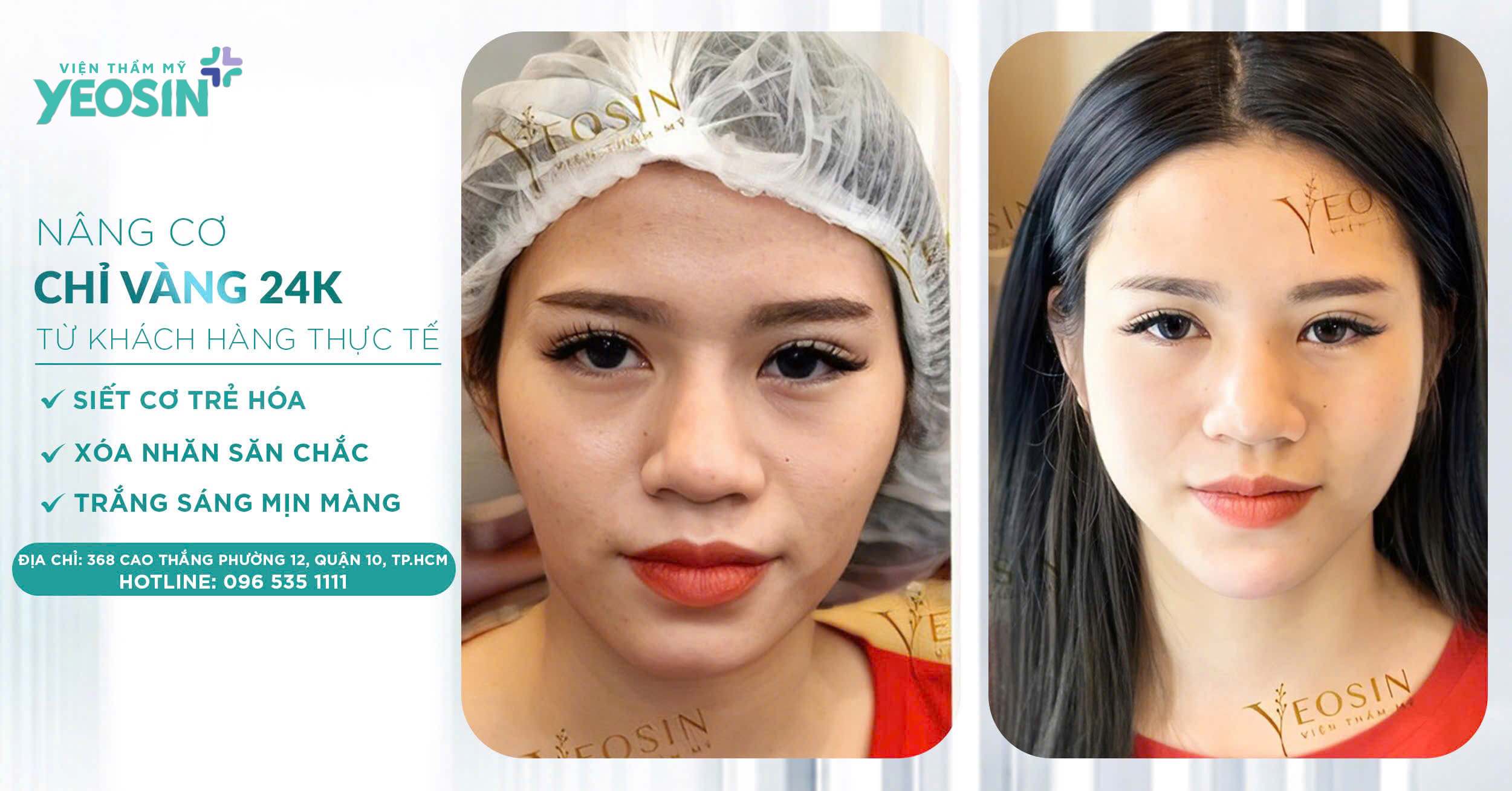 z6532626172783 5c315a9bb5a3fb4b3dd77d680548113c 1