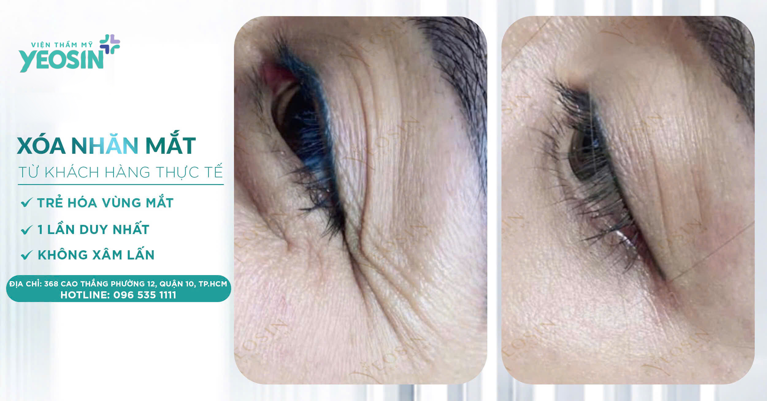 z6537843757913 bf824f5c372cd209772f97b33eb6b711 1