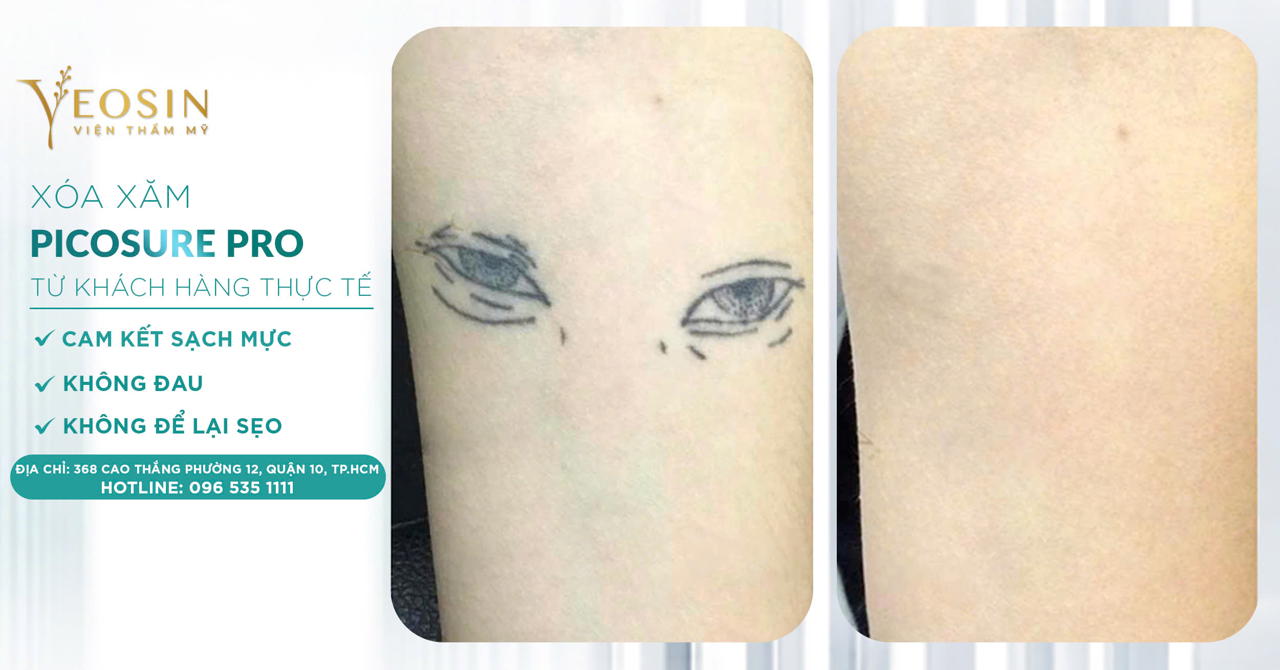 z6537921930292 3dc6e6e35176f27df7aa16e3a1d32ebd