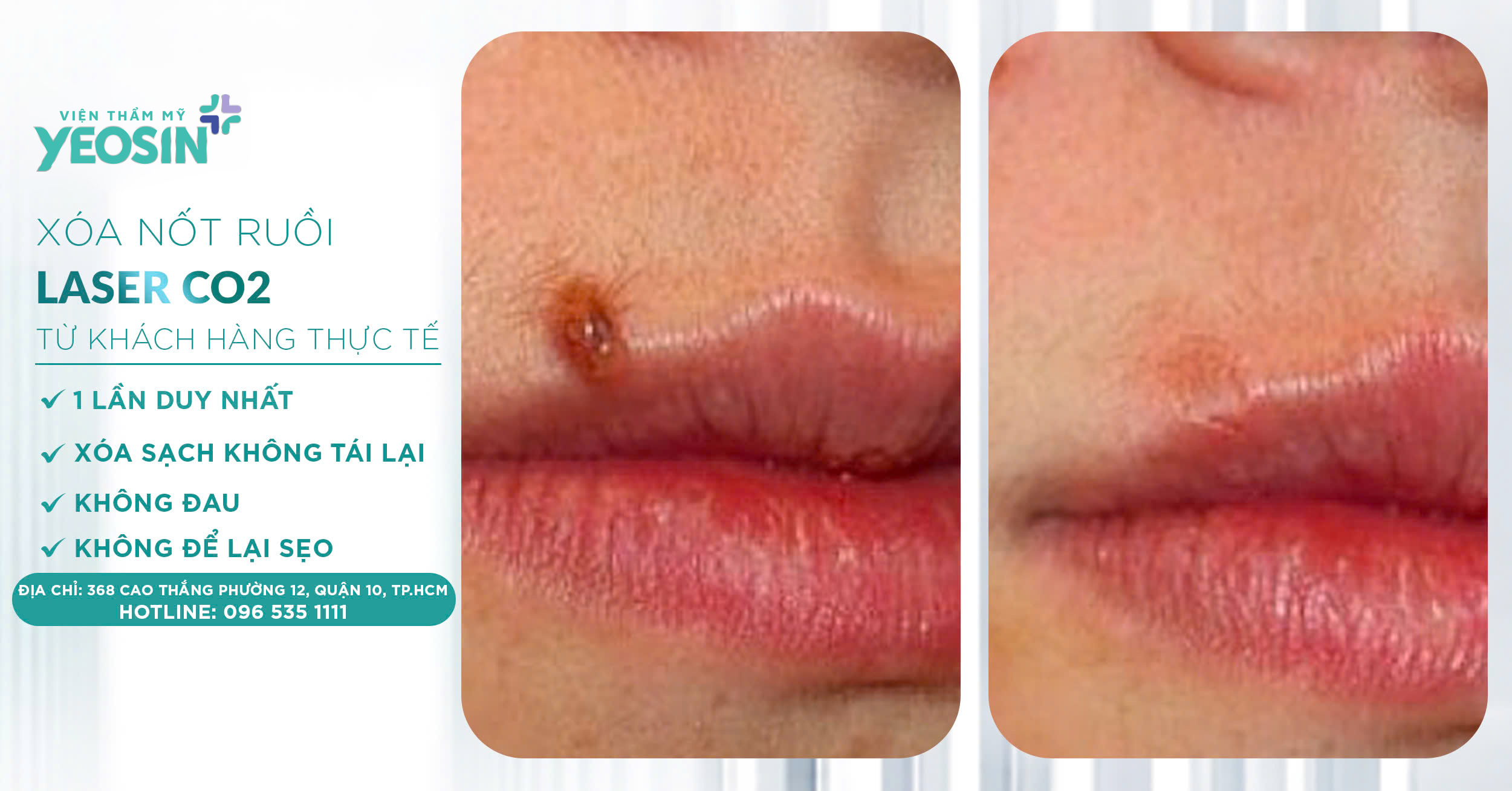 z6537925175279 9b3c83c816d96146bfe81926218c27f2 1