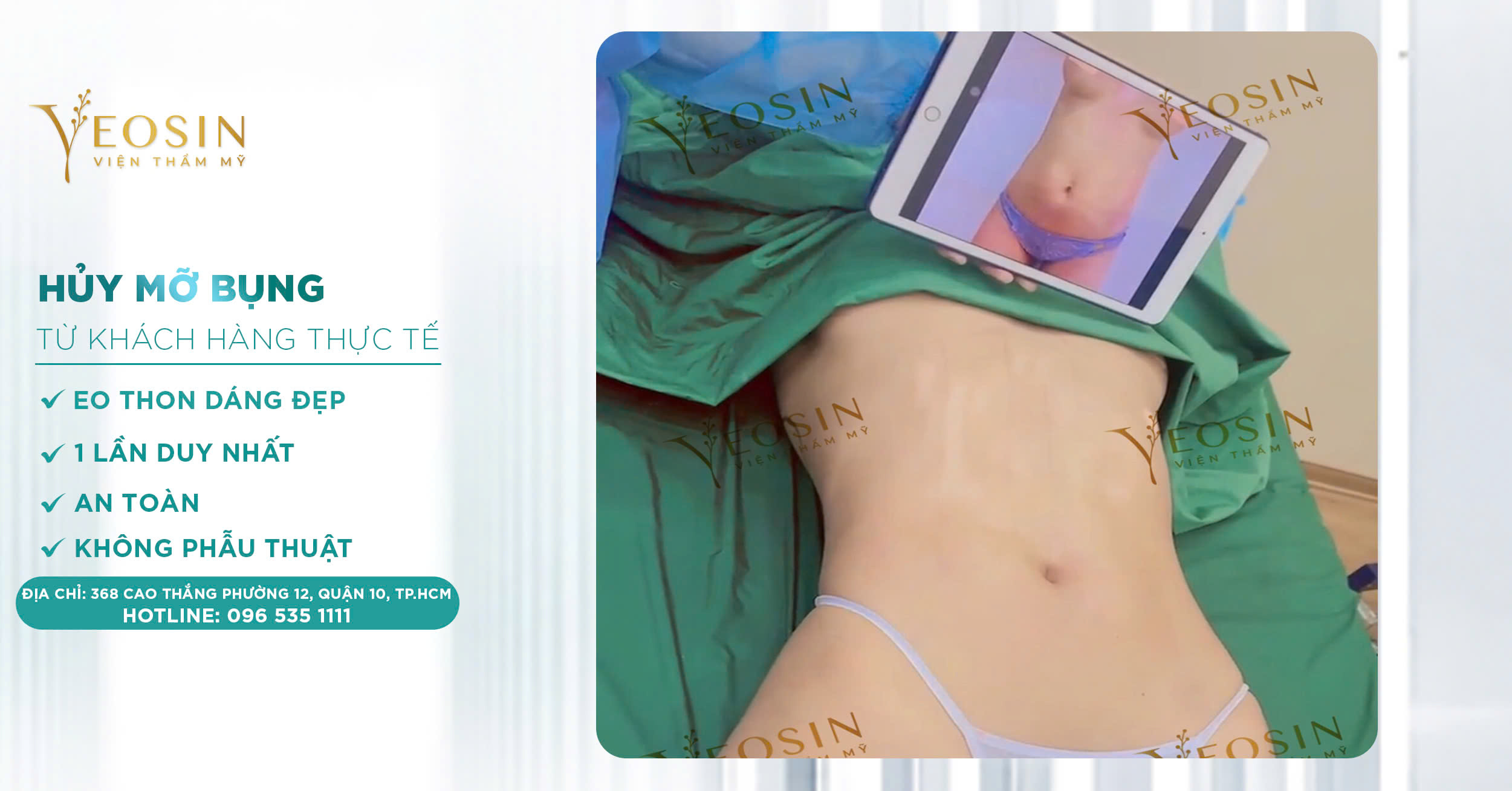 Giảm mỡ bụng hiệu quả, an toàn bằng công nghệ cao 22 z6550427527631 e0170fec42adf48c776b05d22398f749