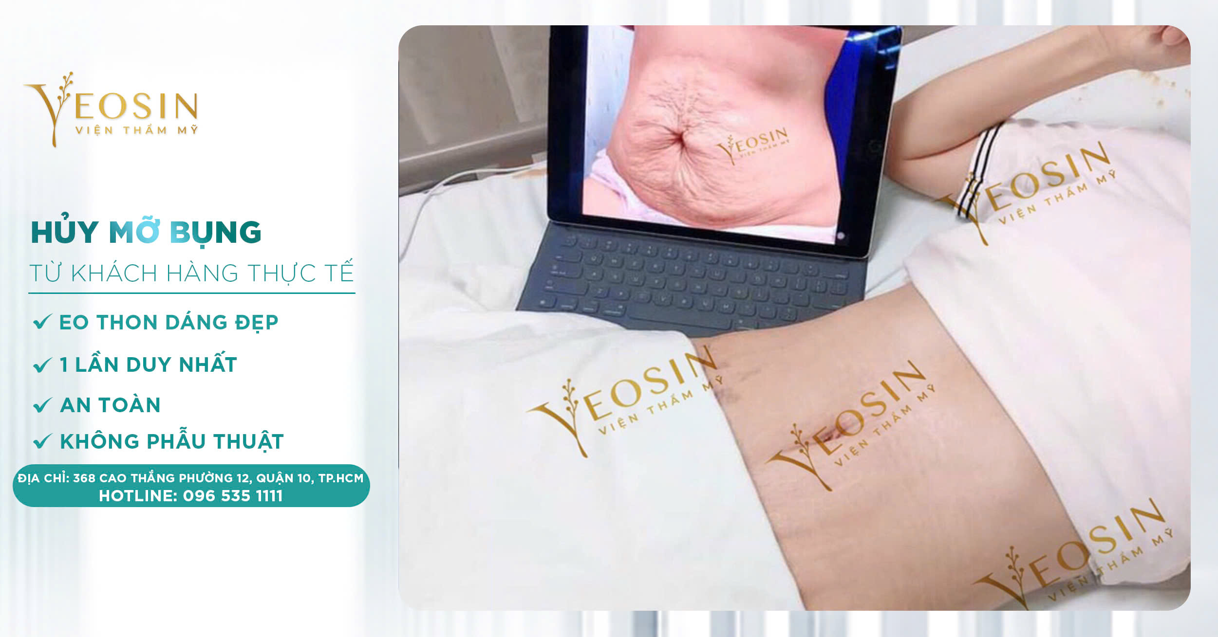 Giảm mỡ bụng hiệu quả, an toàn bằng công nghệ cao 27 z6550427571919 82169796a67027f834a51a27c3a72f13