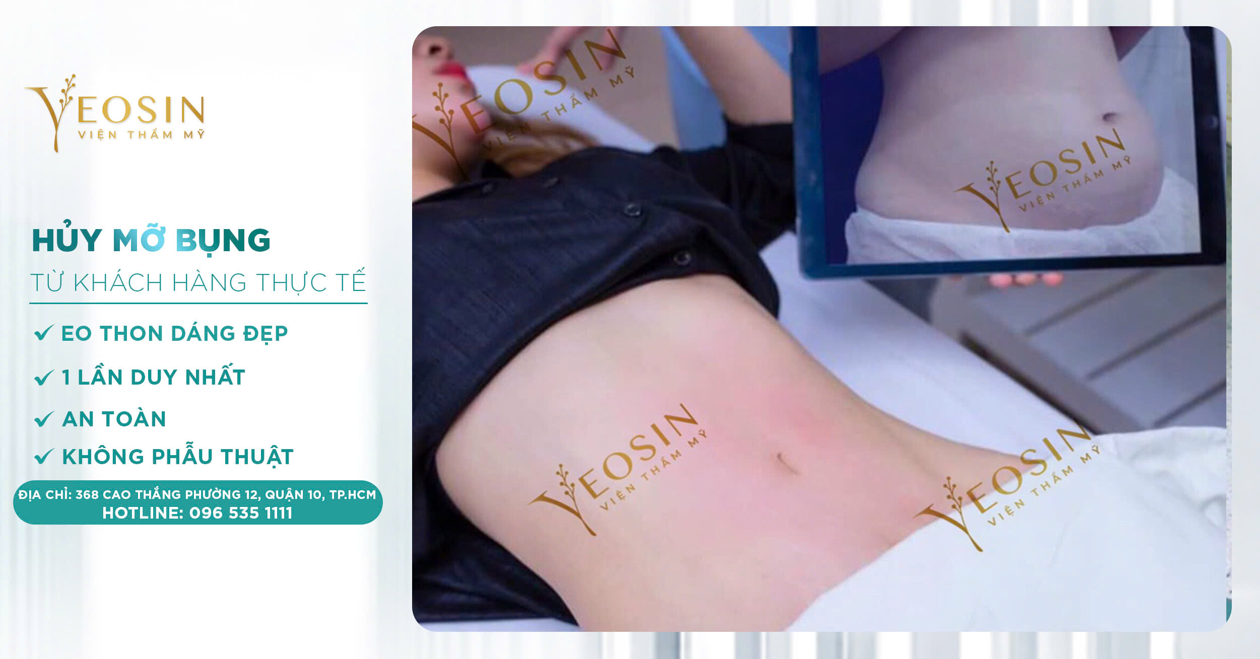 Giảm mỡ bụng hiệu quả, an toàn bằng công nghệ cao 30 z6550427587278 06f8b1a605fe2344ae9d8ea652e4fd21