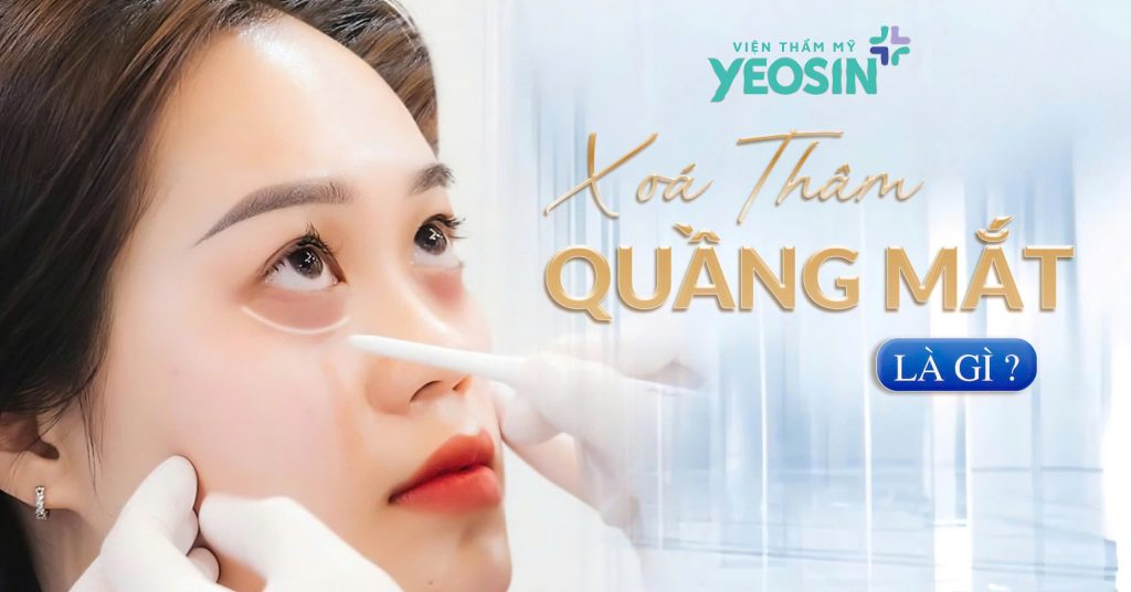 Quầng thâm mắt là gì?