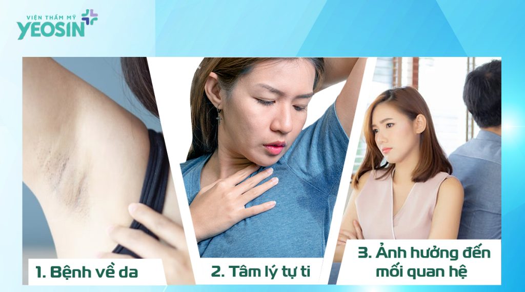 Hôi nách là gì và cách chữa trị hôi nách