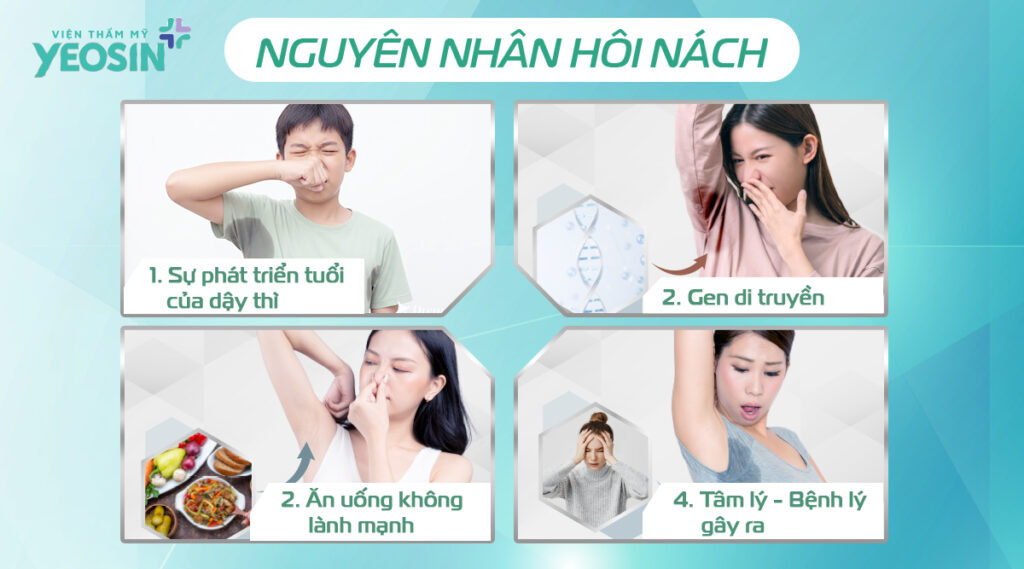 nguyen nhan hoi nach