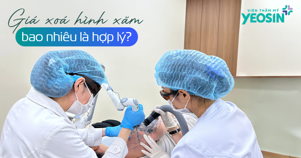 Giá xóa hình xăm bao nhiêu tiền là hợp lý?