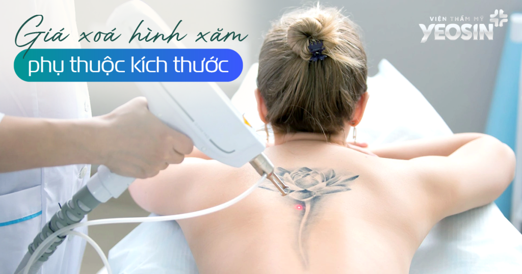 Giá xóa xăm sẽ phụ thuộc vào kích thước hình xăm.