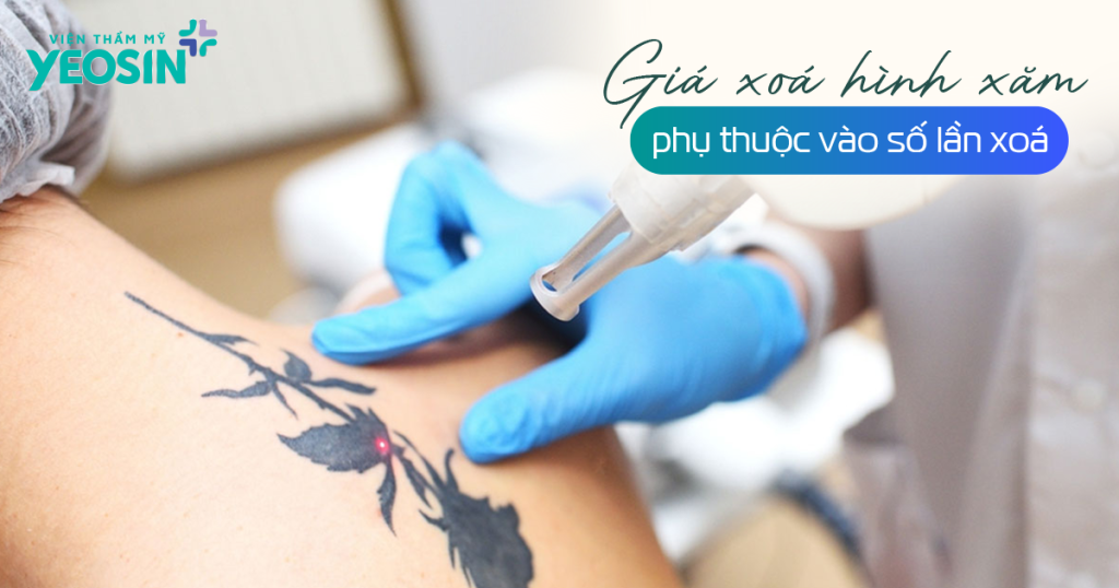 Bảng giá xóa xăm sẽ phụ thuộc vào số lần xóa.