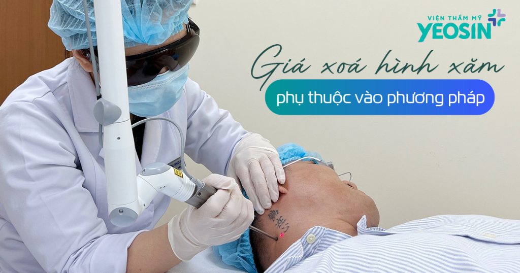 Giá xóa hình xăm sẽ chịu ảnh hưởng bởi phương pháp xóa