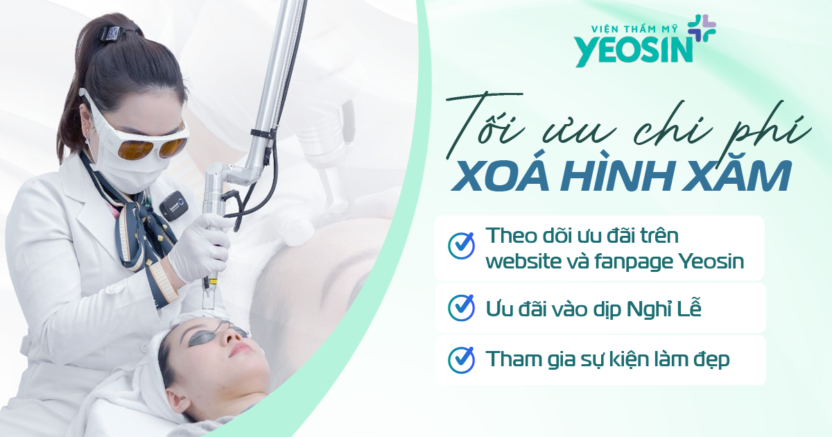 Giá xóa hình xăm - Bảng giá xóa xăm mới 2026 29 6
