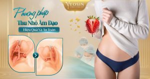 phương pháp thu nhỏ âm đạo