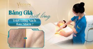 Giá triệt lông nách - Triệt lông nách giá bao nhiêu?
