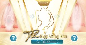 Thu hẹp vùng kín có tốt không, kinh nghiệm thu hẹp vùng kín