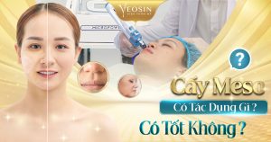 BANNER BAI VIET BIA TIEM MESO CANG BONG DA 2