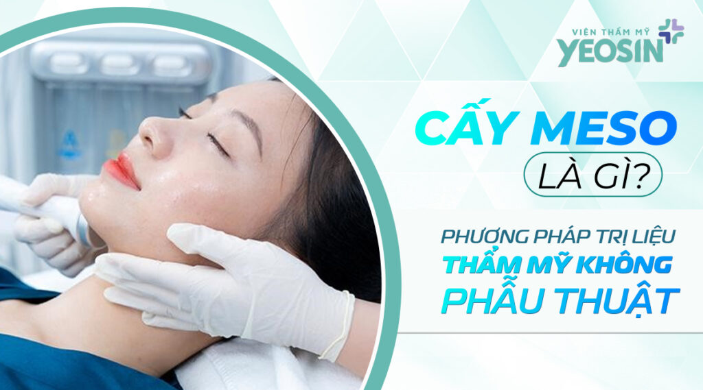 Cấy meso căng bóng da là gì?