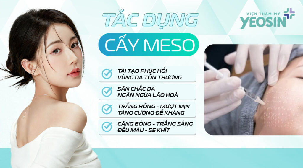 Cấy meso có tốt không và có tác dụng gì?