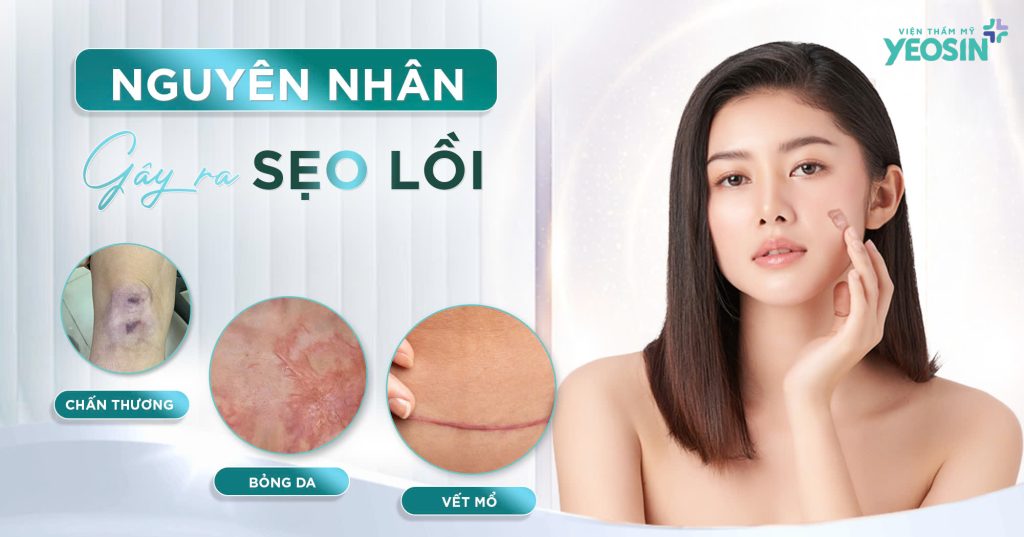 Trị sẹo lồi - Cách trị sẹo lồi bằng Laser Nano Scar 25 Nguyên nhân gây ra sẹo lồi