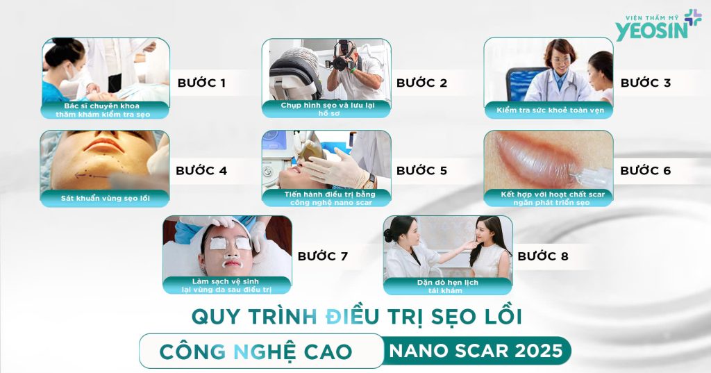 Trị sẹo lồi - Cách trị sẹo lồi bằng Laser Nano Scar 29 Quy trình điều trị sẹo lồi bằng Laser Nano Scar