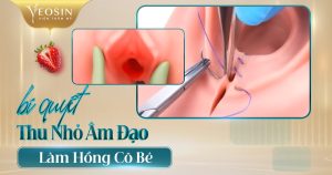 Viện Thẩm Mỹ Quốc Tế Yeosin – Địa chỉ spa làm hồng cô bé (vùng kín) uy tín tại Tphcm