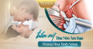 Thẩm mỹ thu nhỏ cô bé