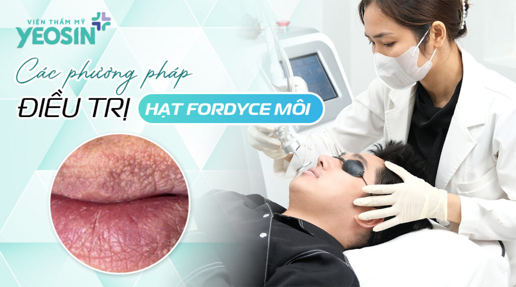 Các phương pháp điều trị hạt trên môi phổ biến