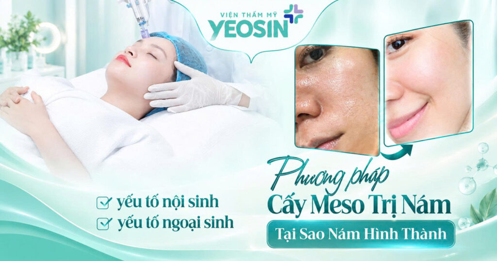 Cấy meso trị nám có hiệu quả không? 6 1789722000100 543195267361827872 301541920615582086 856ead479d82795daf267d346ee7e514