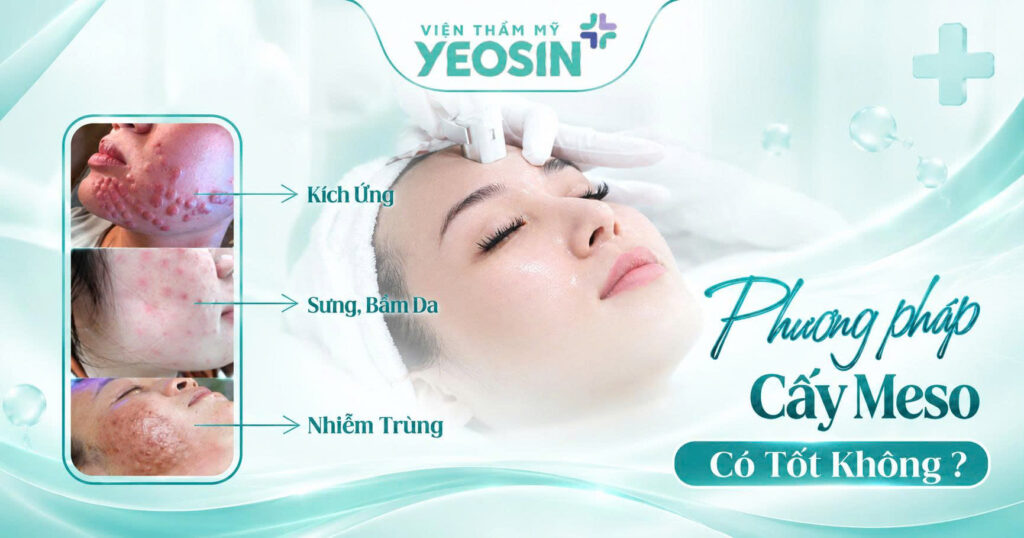 Cấy meso có tốt không? Tác dụng của phương pháp cấy meso 9 1789723087544 543195267361827872 301541920615582086 c22b274cc8038c89d9f24f86c287f5f8