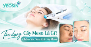 Tác dụng của cấy meso là gì? Chăm sóc sau khi cấy meso?