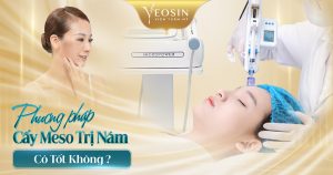 Cấy meso trị nám có hiệu quả không?