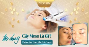 Tác dụng của cấy meso là gì? Chăm sóc sau khi cấy meso?