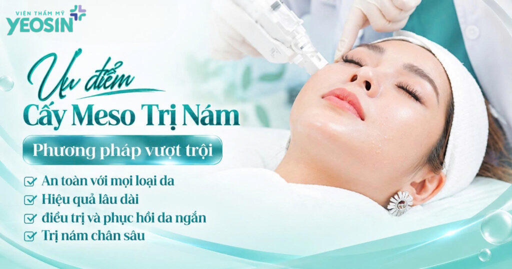 Cấy meso trị nám có hiệu quả không? 8 C1FD845C EFC6 4FEF B074 26DD8CB1F3EA