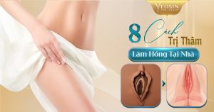 8 CACH TRI THAM LAM HONG TAI NHA