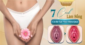 BANNER BIA BAI BLOG YEOSIN 7 CACH LAM HONG TAI NHA HIEU QUA
