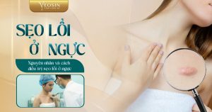 Seo loi o nguc Nguyen nhan va cach dieu tri seo loi o nguc